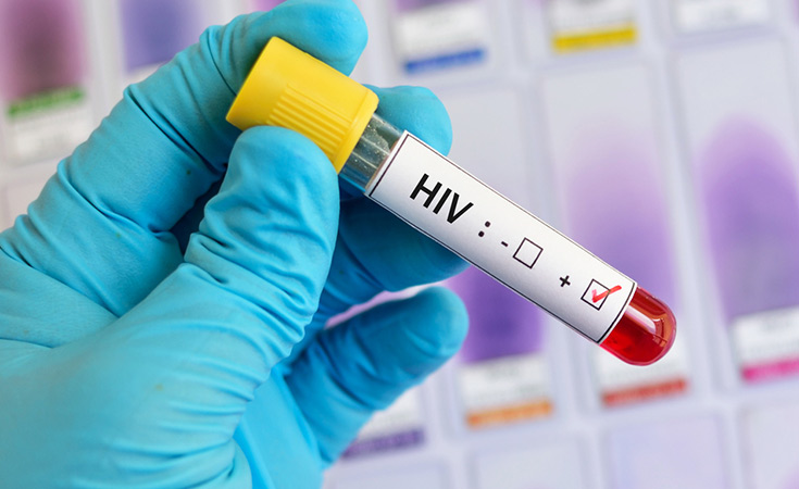 El PREP es un método nuevo para prevenir el VIH, sin embargo no cubre otras enfermedades. 